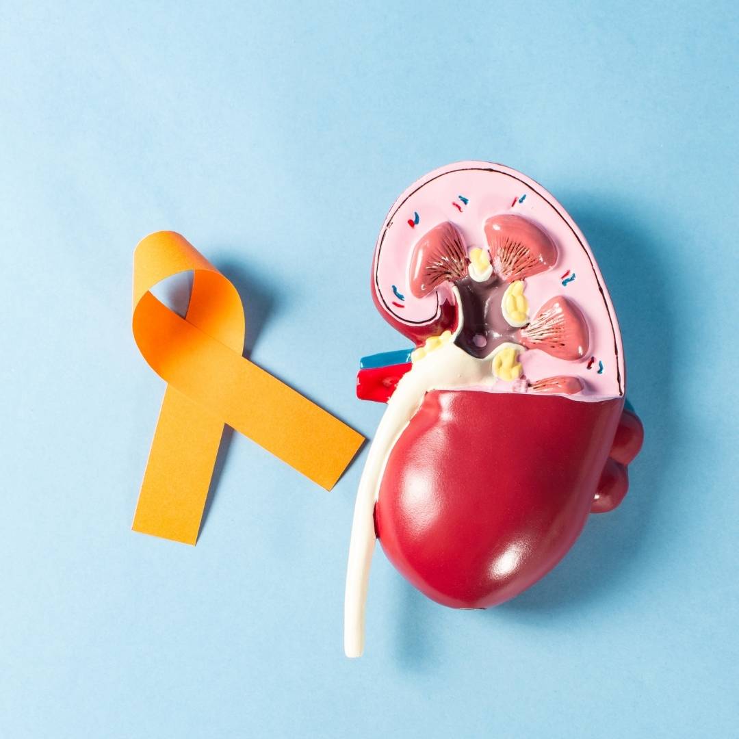 Especialista en cáncer de riñón en Culiacán