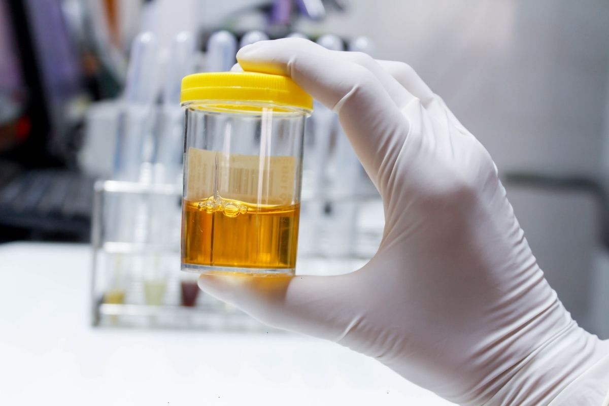 Especialista en proteínas en la orina en Culiacán